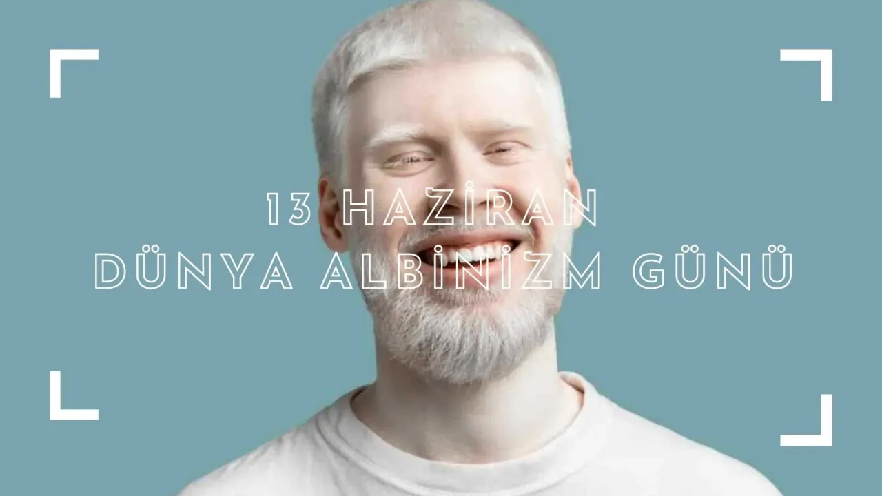 13 Haziran Dünya Albinizm Günü